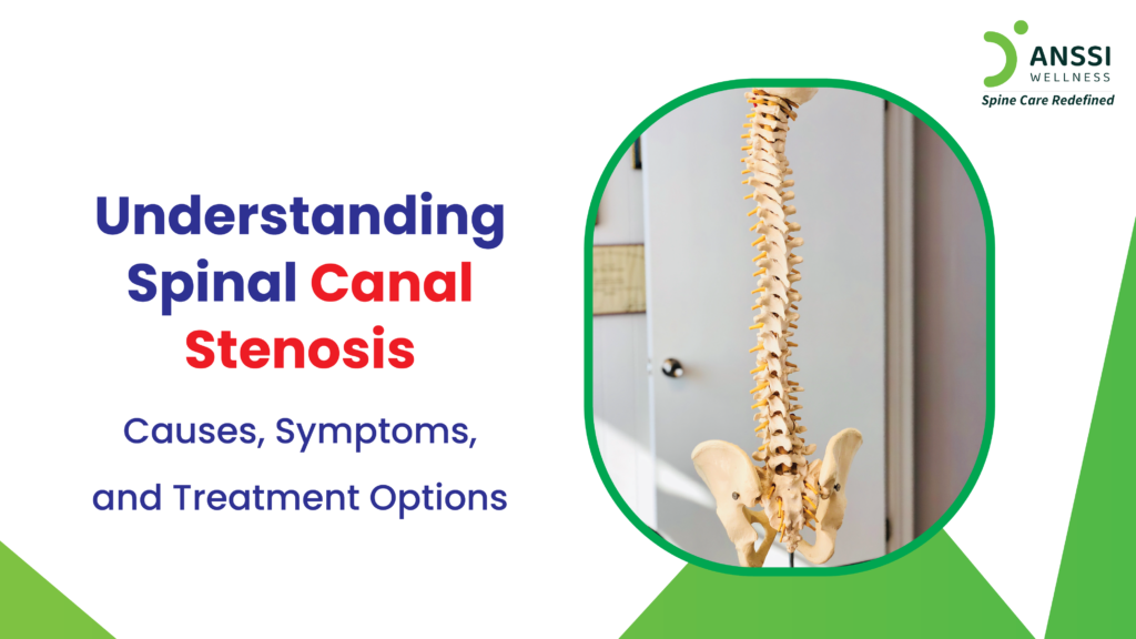 Spinal canal stenosis is a condition that commonly affects older adults due to natural degeneration.